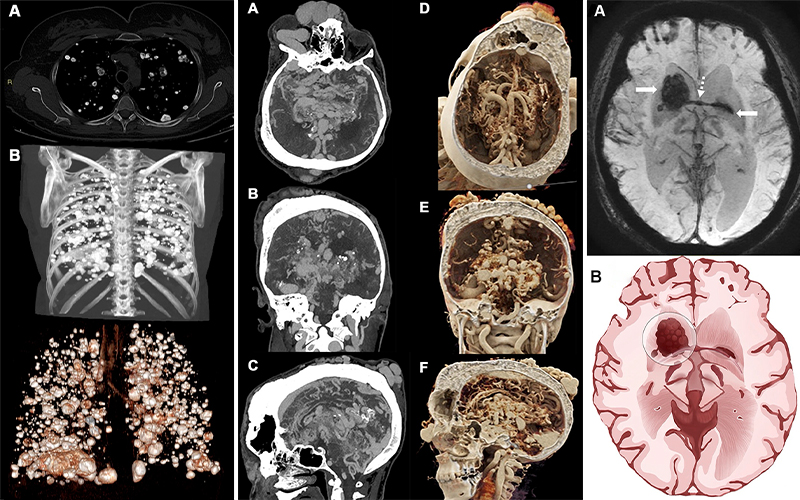 Top Radiology journal images for 2024